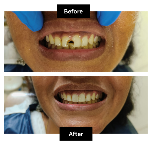 Blossom Dental Care Pune Clinic Interior and Dental Treatment Setup