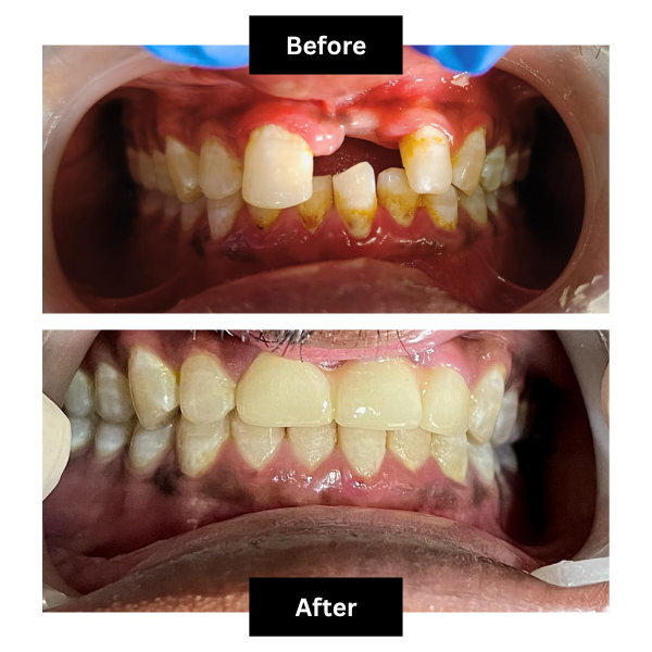 Blossom Dental Care Pune Clinic Interior and Dental Treatment Setup