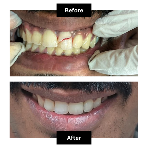 Blossom Dental Care Pune Clinic Interior and Dental Treatment Setup