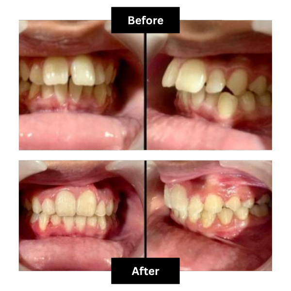 Blossom Dental Care Pune Clinic Interior and Dental Treatment Setup